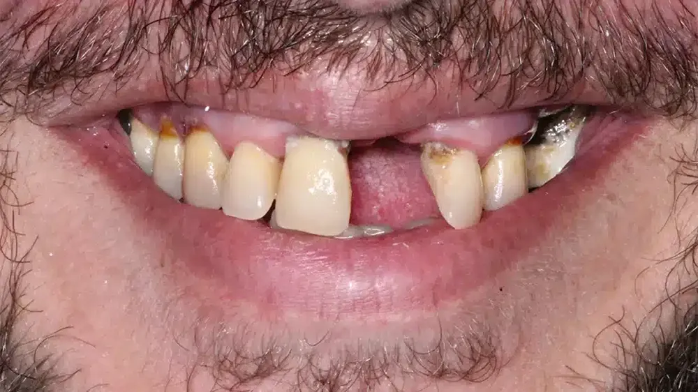before after smile makeover 5
