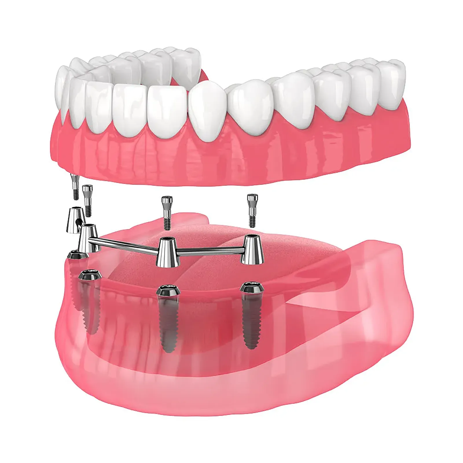 dentures white