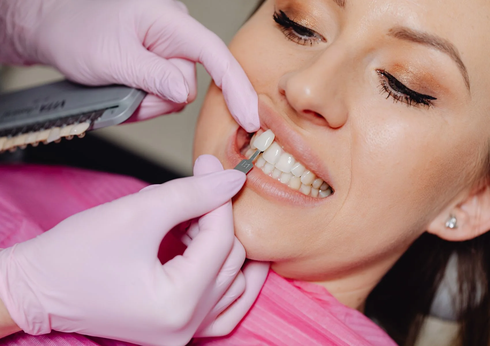 Top Cosmetic Dentists in Rancho and San Bernardino