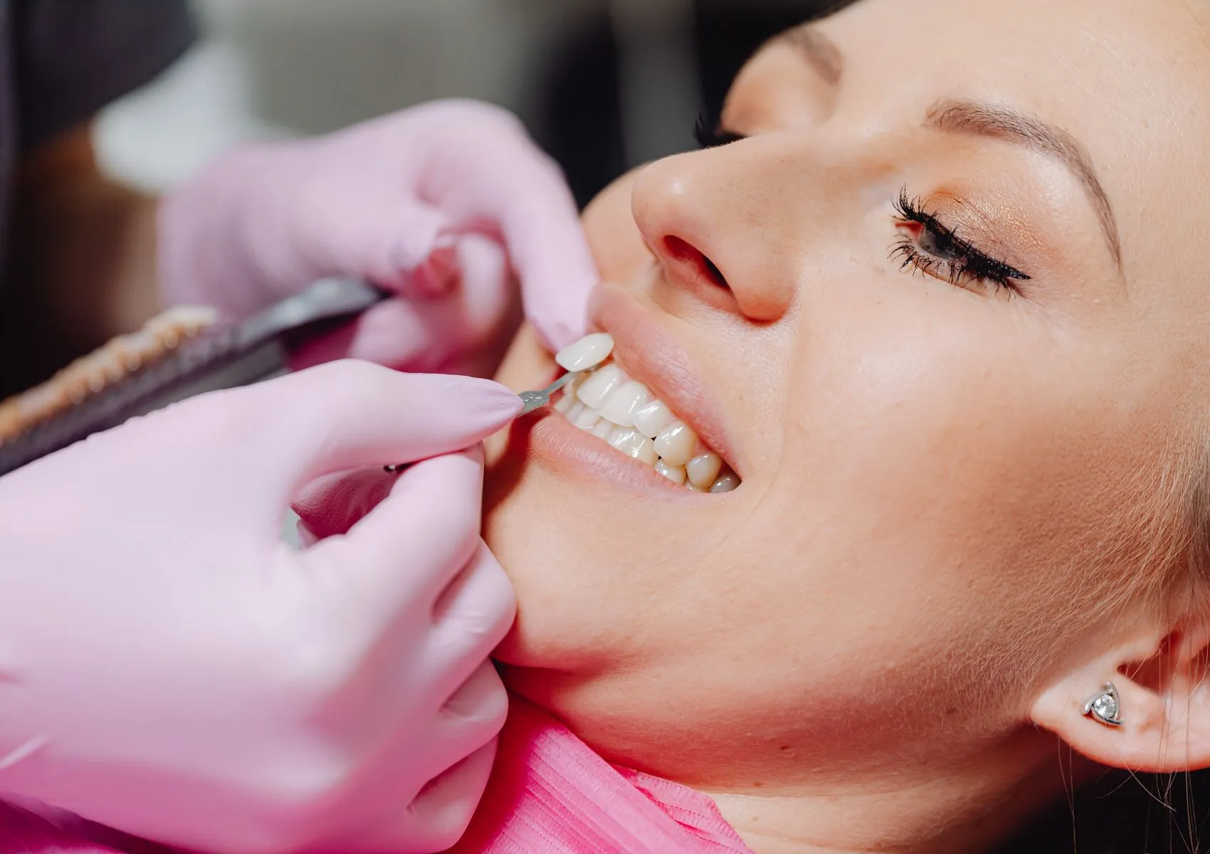 Choosing a Cosmetic Dentist in Rancho