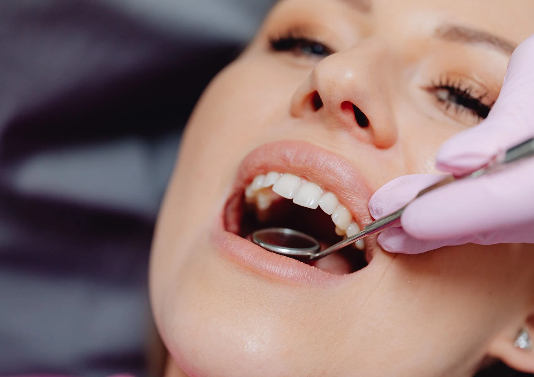 Is Laser Gum Treatment Right for Me?