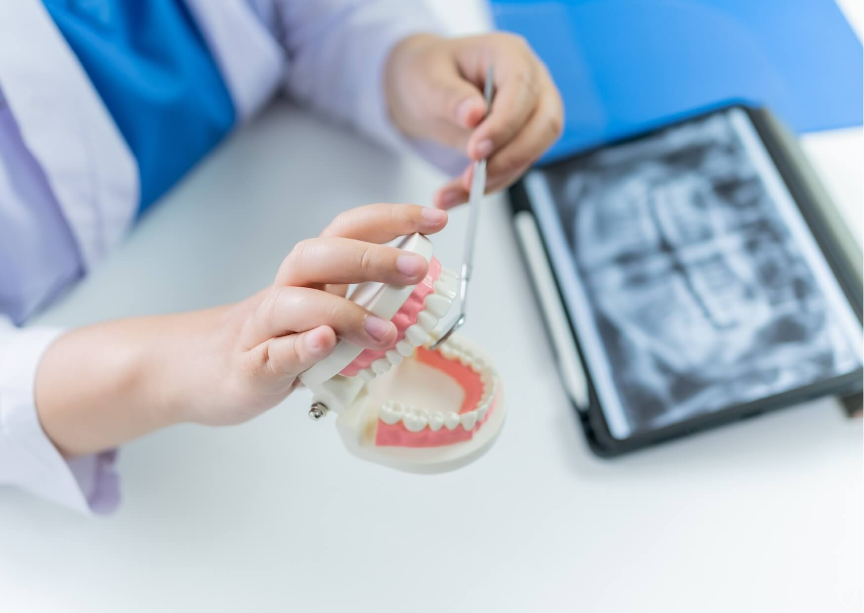 Dental model and X-ray used to explain how bone grafting is evaluated before placing a dental implant.